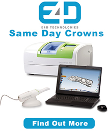 Same-Day Crowns image, link to Same-Day Crown Information